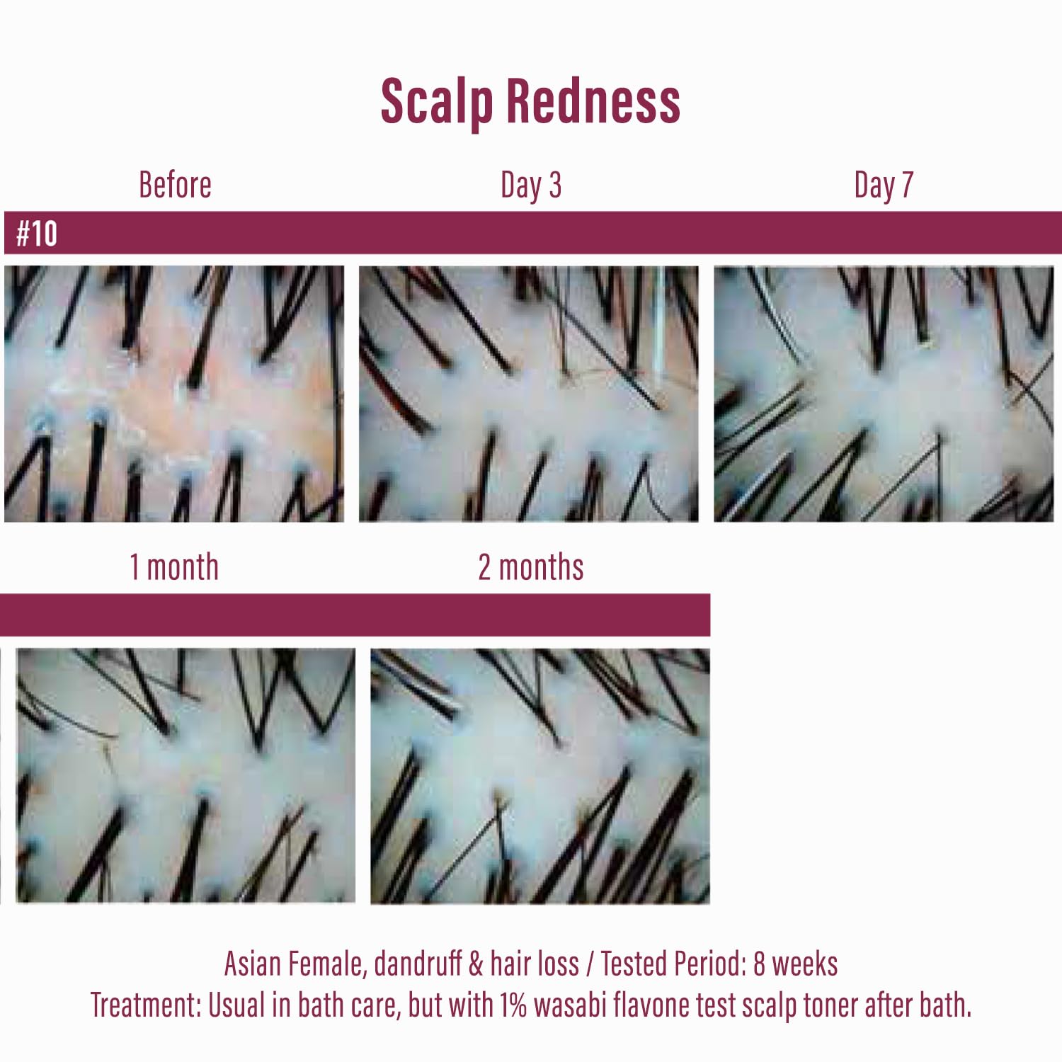 NatureLab Diane Perfect Beauty Extra Hair Fall Control Shampoo [450ml] 